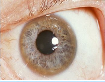 Case Study- Wilson’s Disease